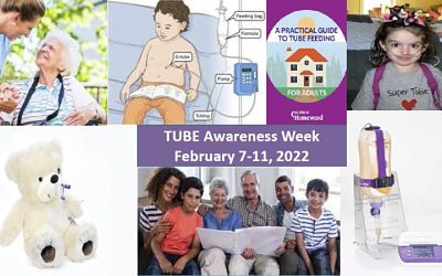 A szondatáplálás hete: 2022. február 7-11.